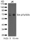 Spleen Associated Tyrosine Kinase antibody, LS-C203610, Lifespan Biosciences, Western Blot image 