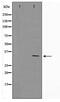 SURF1 Cytochrome C Oxidase Assembly Factor antibody, TA347735, Origene, Western Blot image 