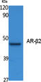 Adrenoceptor Beta 2 antibody, STJ96413, St John