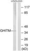 Growth hormone-inducible transmembrane protein antibody, LS-C120013, Lifespan Biosciences, Western Blot image 