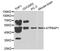 ATPase H+ Transporting Accessory Protein 1 antibody, PA5-37328, Invitrogen Antibodies, Western Blot image 