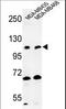 Exostosin Like Glycosyltransferase 3 antibody, LS-C167869, Lifespan Biosciences, Western Blot image 
