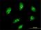 Mesenchyme Homeobox 2 antibody, H00004223-M10, Novus Biologicals, Immunofluorescence image 