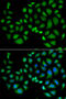 Chloride Intracellular Channel 1 antibody, 22-159, ProSci, Immunofluorescence image 