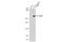 ATM Serine/Threonine Kinase antibody, GTX70105, GeneTex, Western Blot image 