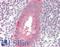 Hexokinase 2 antibody, LS-B8935, Lifespan Biosciences, Immunohistochemistry paraffin image 