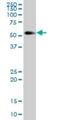 Kininogen 1 antibody, H00003827-B01P, Novus Biologicals, Western Blot image 