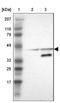 Acyl-CoA Thioesterase 4 antibody, NBP1-83539, Novus Biologicals, Western Blot image 