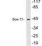 SRY-Box 11 antibody, LS-C200010, Lifespan Biosciences, Western Blot image 