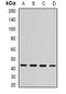 ST3 Beta-Galactoside Alpha-2,3-Sialyltransferase 5 antibody, orb341400, Biorbyt, Western Blot image 