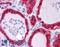 Tetraspanin 9 antibody, LS-B5067, Lifespan Biosciences, Immunohistochemistry paraffin image 