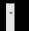 Hydroxymethylbilane Synthase antibody, GTX02363, GeneTex, Immunoprecipitation image 