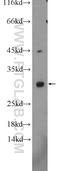 Ankyrin Repeat Domain 7 antibody, 21023-1-AP, Proteintech Group, Western Blot image 