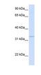 Geranylgeranyl Diphosphate Synthase 1 antibody, NBP1-53050, Novus Biologicals, Western Blot image 