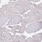 Lipin 2 antibody, HPA030550, Atlas Antibodies, Immunohistochemistry frozen image 