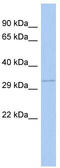 G Protein Subunit Beta 1 antibody, TA335041, Origene, Western Blot image 