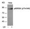 Ribosomal Protein S6 Kinase A1 antibody, GTX50169, GeneTex, Western Blot image 