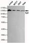 Kinesin Family Member 11 antibody, STJ99033, St John