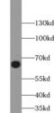 Interferon-induced guanylate-binding protein 1 antibody, FNab03373, FineTest, Western Blot image 