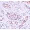 Autophagy Related 3 antibody, LS-C115848, Lifespan Biosciences, Immunohistochemistry paraffin image 