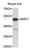 Mitochondrial Elongation Factor 1 antibody, STJ26301, St John