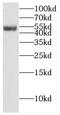 Eukaryotic Translation Initiation Factor 3 Subunit E antibody, FNab02707, FineTest, Western Blot image 