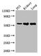 Collagenase 3 antibody, A55291-100, Epigentek, Western Blot image 