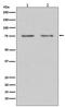 Histone Deacetylase 10 antibody, M05215, Boster Biological Technology, Western Blot image 