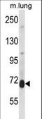 Protein Kinase C Delta antibody, LS-C164548, Lifespan Biosciences, Western Blot image 