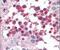 Heat Shock Protein Family A (Hsp70) Member 5 antibody, PA5-11418, Invitrogen Antibodies, Immunohistochemistry paraffin image 
