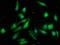 NAD(P) Dependent Steroid Dehydrogenase-Like antibody, LS-C670280, Lifespan Biosciences, Immunofluorescence image 
