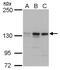 MutS Homolog 3 antibody, GTX103228, GeneTex, Western Blot image 