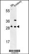 Glutamate-Cysteine Ligase Modifier Subunit antibody, TA325093, Origene, Western Blot image 