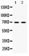 Eukaryotic Translation Initiation Factor 2 Alpha Kinase 2 antibody, PB9803, Boster Biological Technology, Western Blot image 