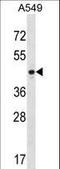 Pentraxin 3 antibody, LS-C162320, Lifespan Biosciences, Western Blot image 