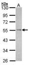 NADH:Ubiquinone Oxidoreductase Core Subunit V1 antibody, PA5-21426, Invitrogen Antibodies, Western Blot image 