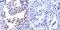 TIMP Metallopeptidase Inhibitor 1 antibody, MA1-773, Invitrogen Antibodies, Immunohistochemistry paraffin image 