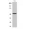 Activating Transcription Factor 2 antibody, LS-C382199, Lifespan Biosciences, Western Blot image 