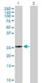 Ribosomal Protein L10 Like antibody, H00140801-B01P, Novus Biologicals, Western Blot image 