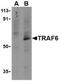 TNF Receptor Associated Factor 6 antibody, TA306124, Origene, Western Blot image 