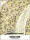 Cyclin A2 antibody, 62-798, ProSci, Immunohistochemistry paraffin image 