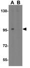 Toll Like Receptor 9 antibody, GTX31295, GeneTex, Western Blot image 