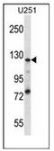 SEL1L Family Member 3 antibody, AP52278PU-N, Origene, Western Blot image 