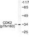 Cyclin Dependent Kinase 2 antibody, LS-C177885, Lifespan Biosciences, Western Blot image 