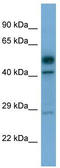 Serine/Threonine Kinase 17a antibody, TA344176, Origene, Western Blot image 