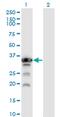 Aprataxin antibody, MA5-22070, Invitrogen Antibodies, Western Blot image 