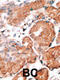 Guanylate Cyclase Activator 1A antibody, 58-190, ProSci, Immunohistochemistry paraffin image 