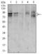 Forkhead Box P1 antibody, GTX60643, GeneTex, Western Blot image 