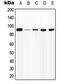 Interferon Gamma Receptor 1 antibody, GTX32197, GeneTex, Western Blot image 