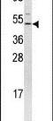 Retroviral integration site protein Fli-1 antibody, PA5-13441, Invitrogen Antibodies, Western Blot image 